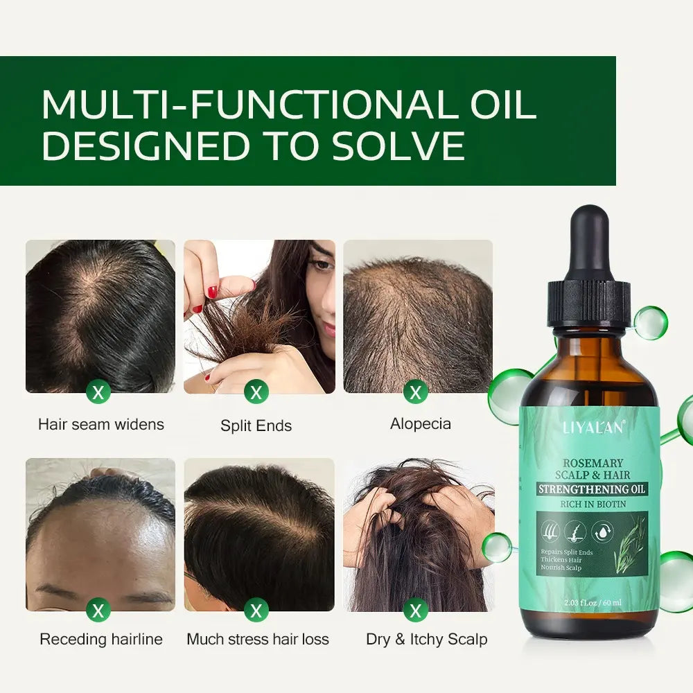 Rosemary Scalp & Hair Growth Oil